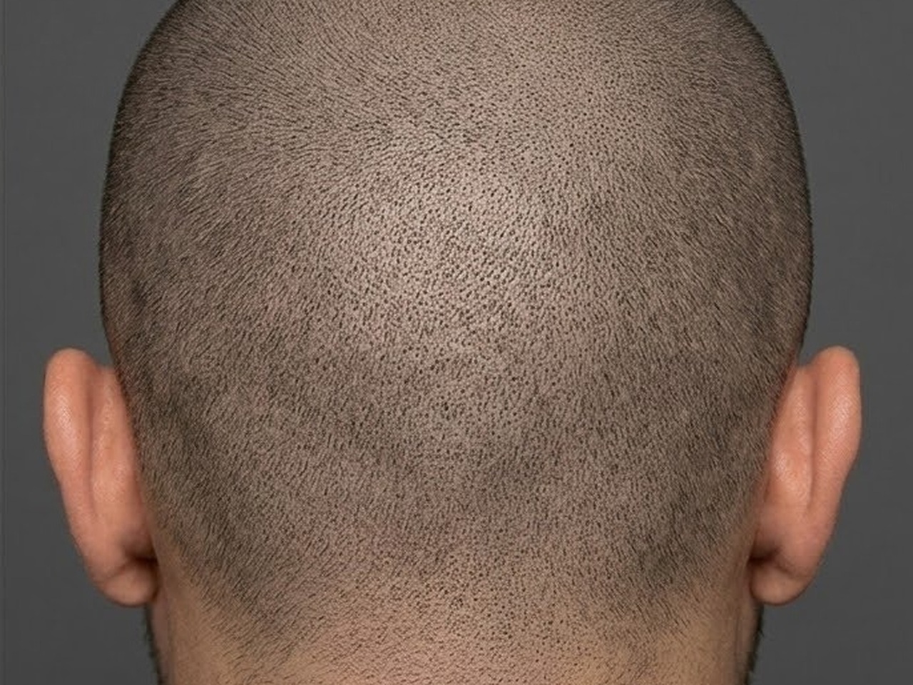 Scar Camouflage